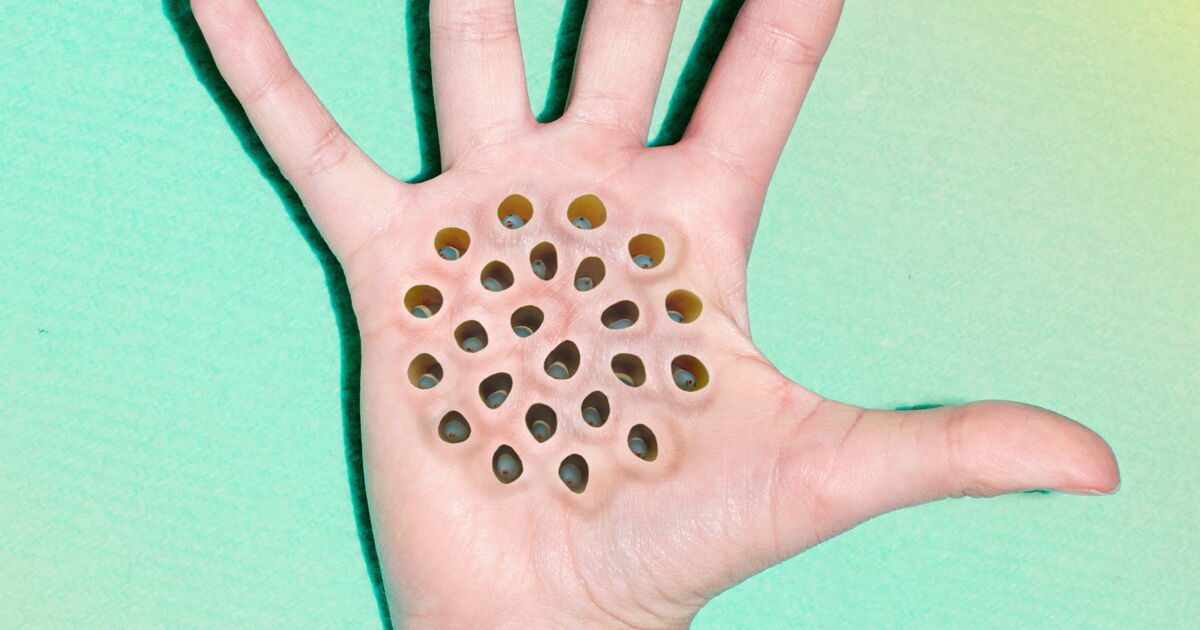 C'est quoi la peur des trous ? - neonmag.fr
